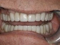 Konig Center for Cosmetic & Comprehensive Dentistry smile photos
